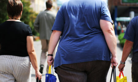 obezitate, sursa foto dreamstime