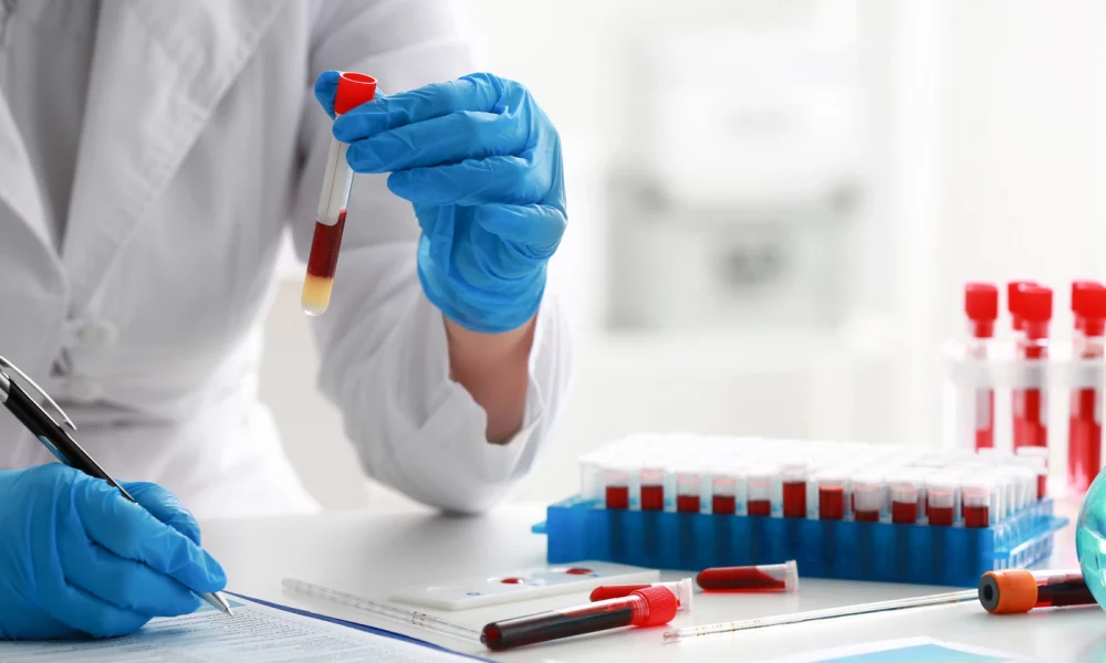 O nouă descoperire medicală! Testul de sânge care depistează cancerul din fază incipientă