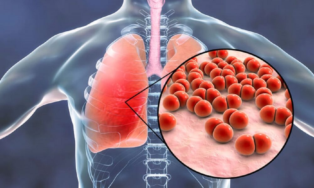 Mare grijă la simptome! Cele mai răspândite boli infecțioase din România