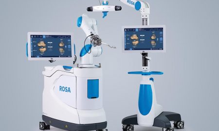 ROSA robot chirurgical Sursa foto Arhiva personala