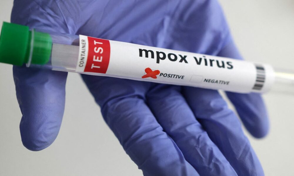 Studiu: Noua variantă de mpox se răspândește de la om la om